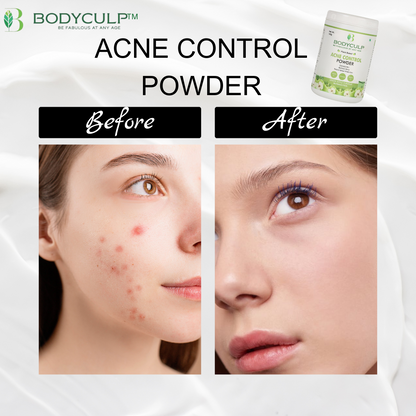 Bodyculp Acne Control Powder, 90 Day's pack